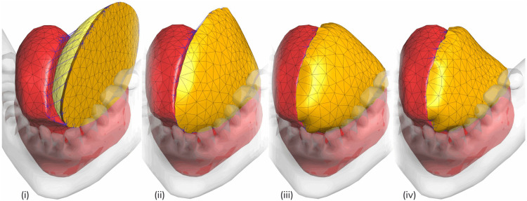 Fig 3
