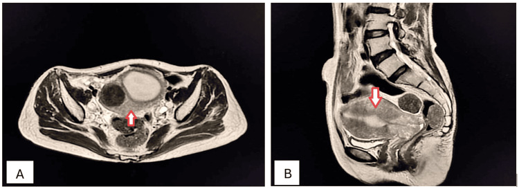 Figure 13