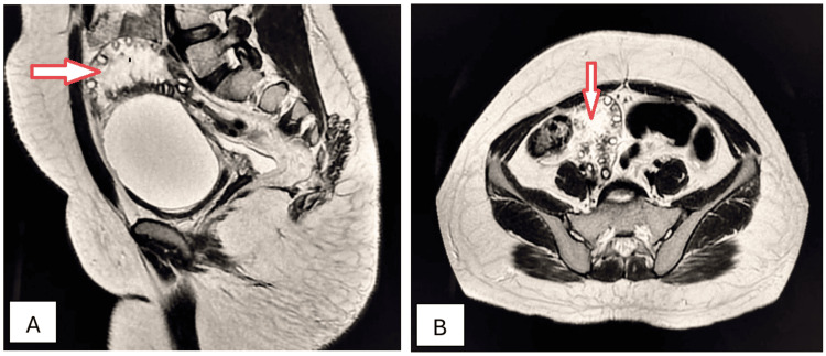 Figure 14