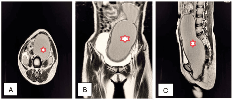 Figure 16