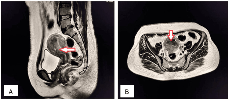 Figure 17