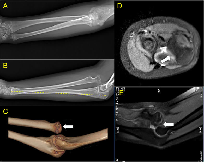 Figure 1