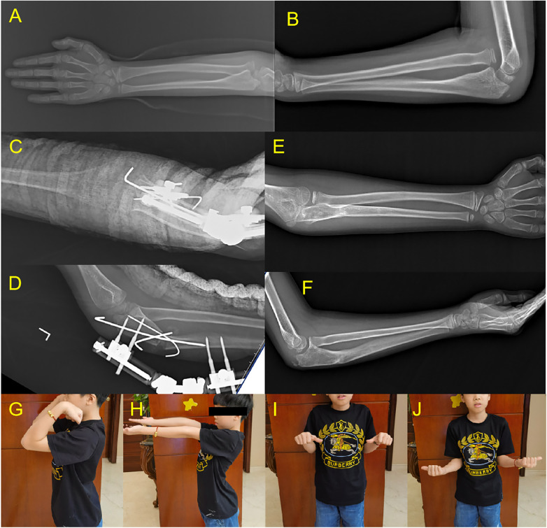 Figure 3