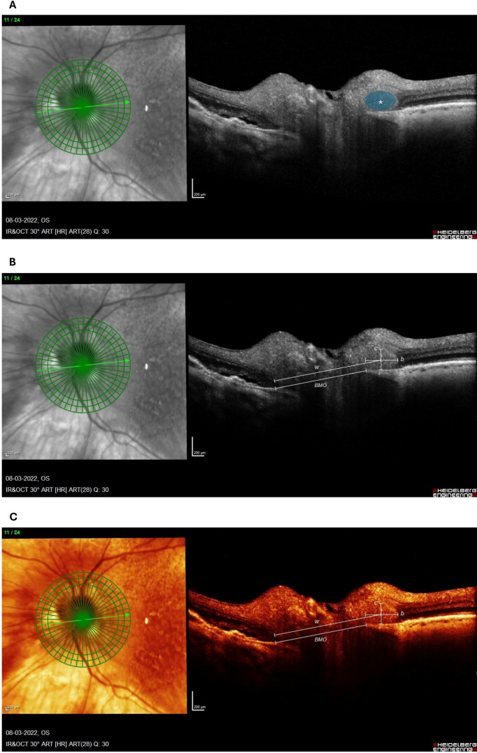 Figure 1