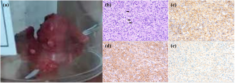 Figure 4