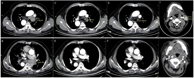Figure 3
