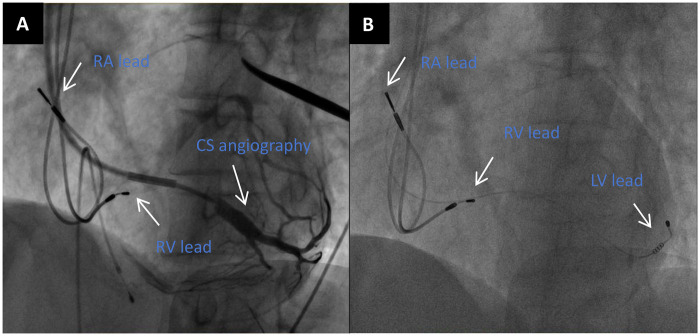 Figure 2
