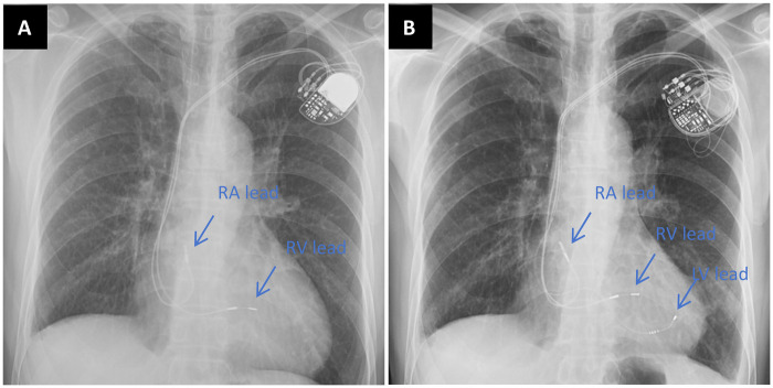 Figure 3