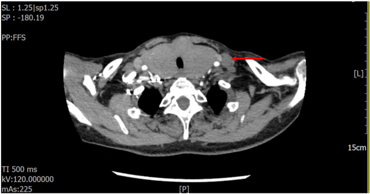 Figure 2