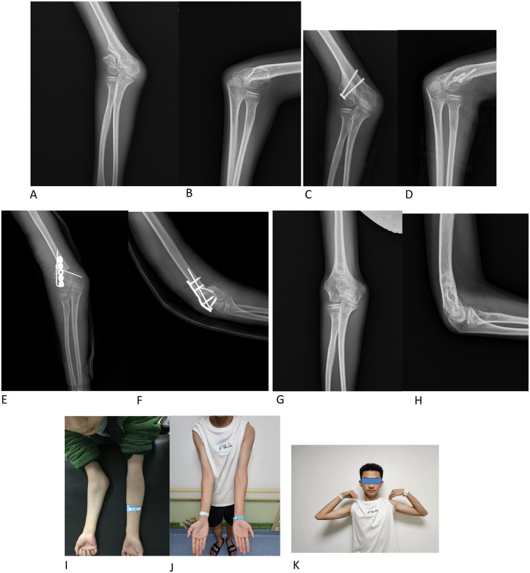 Figure 1