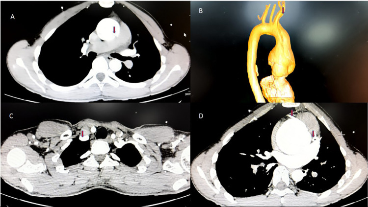 Figure 1