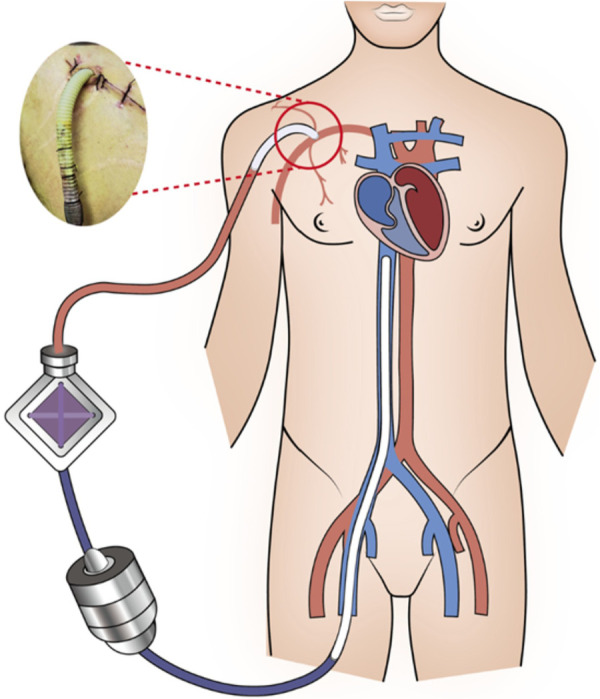 Figure 3
