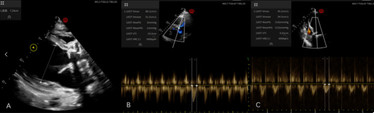 Figure 4
