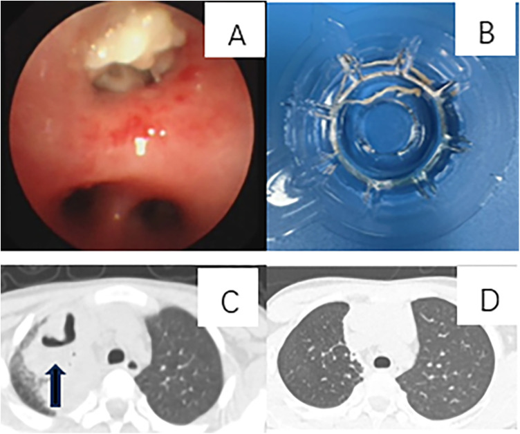 Figure 2