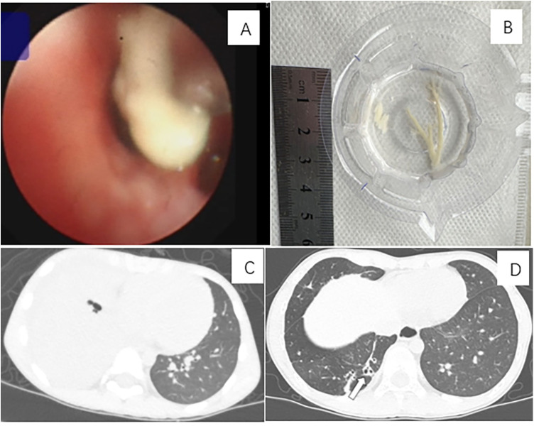Figure 3
