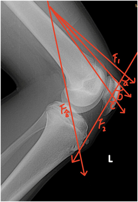 Figure 2