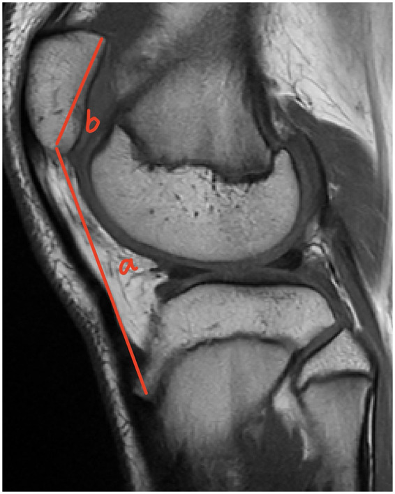 Figure 4