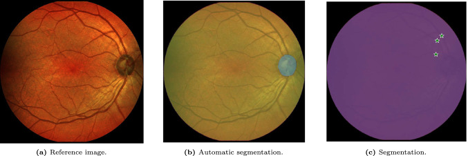 Figure 21