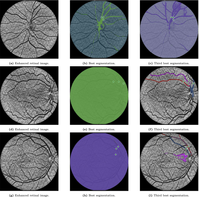 Figure 22