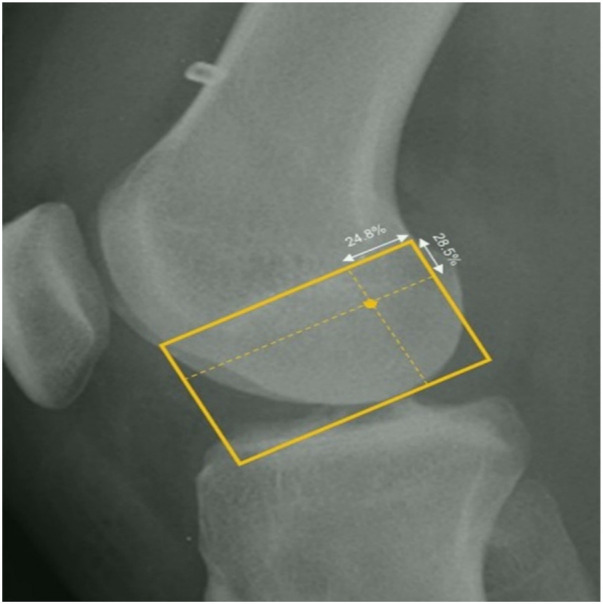 Figure 1