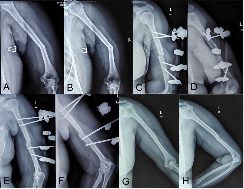 Figure 2