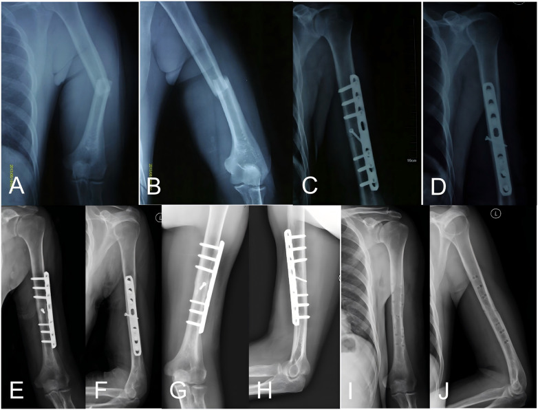 Figure 3