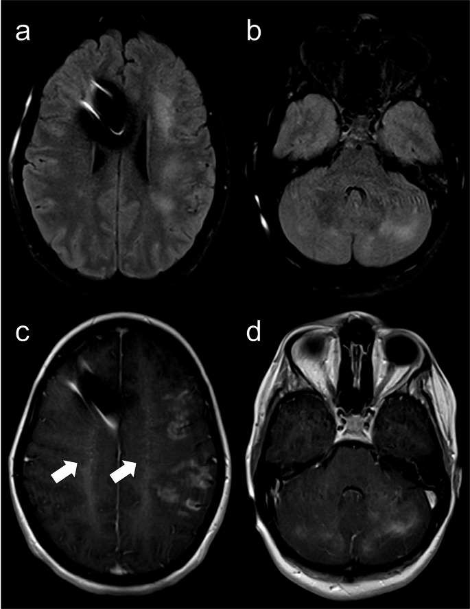 Figure 12