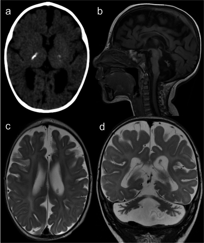 Figure 15