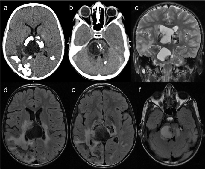Figure 16
