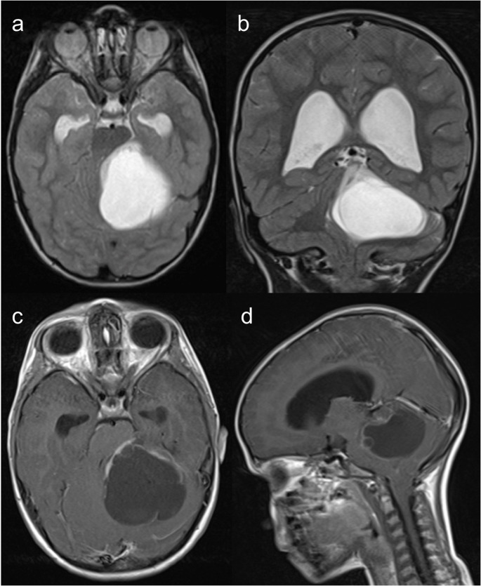 Figure 17