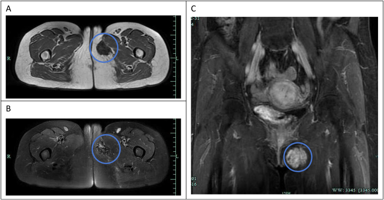 Figure 1