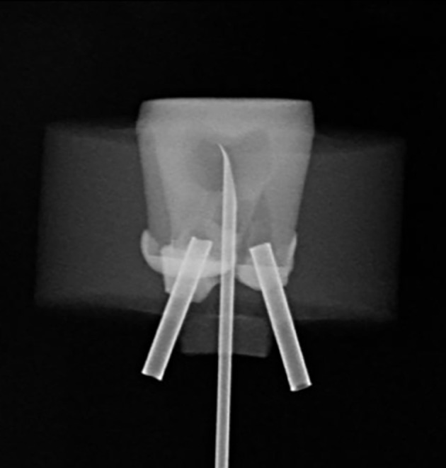 Fig 2
