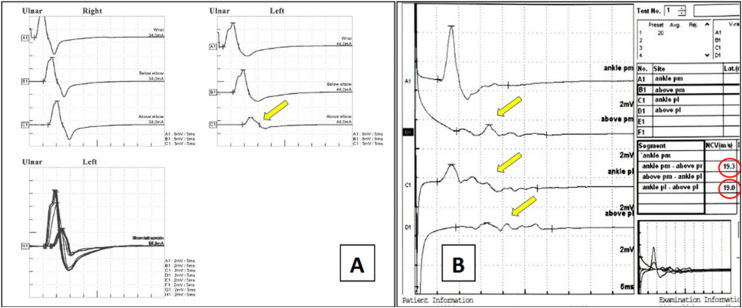 Figure 10