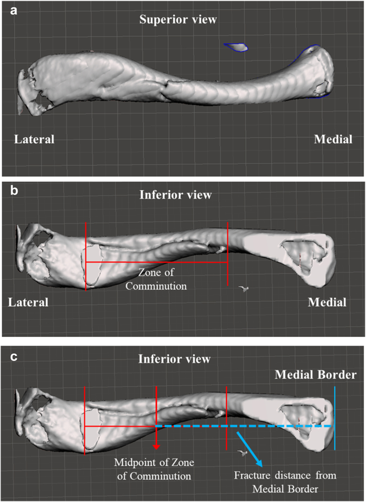 Figure 14