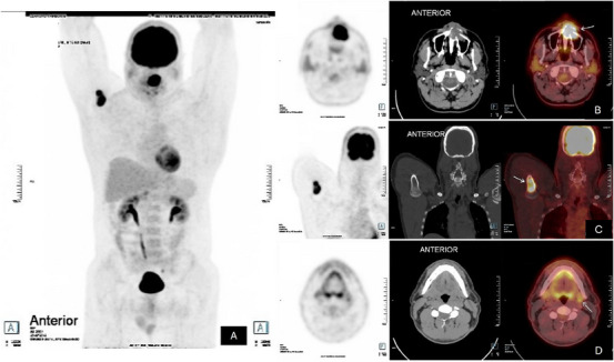 FIGURE 3