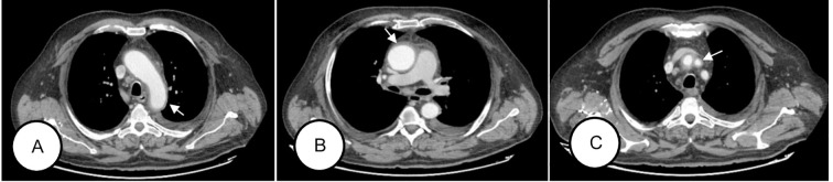 Figure 1