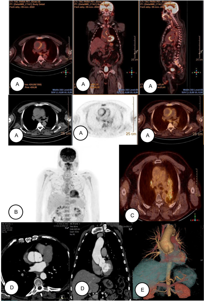 Figure 3