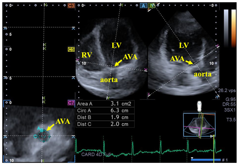 Figure 2