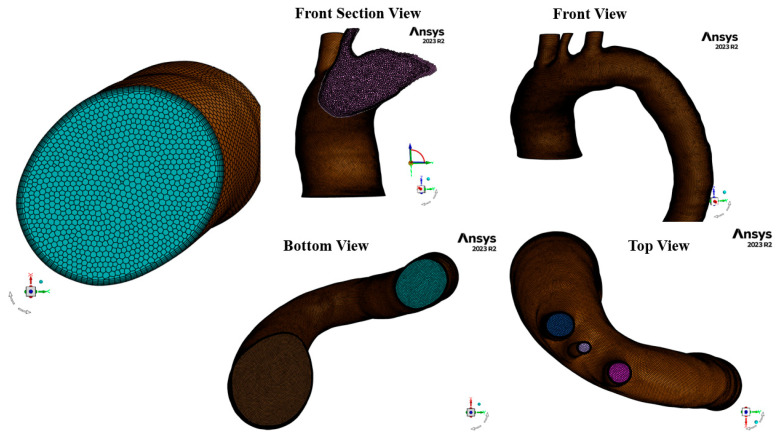 Figure 2
