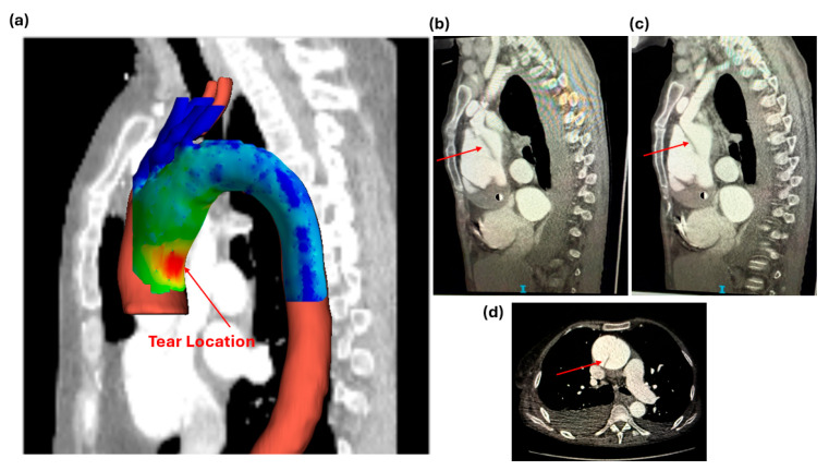 Figure 6