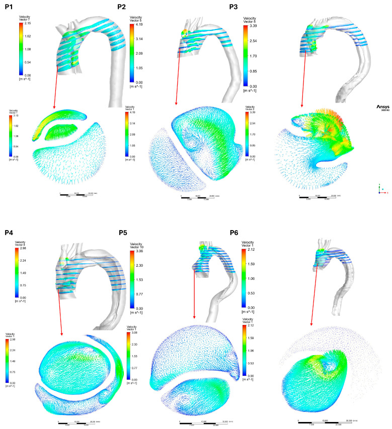 Figure 11
