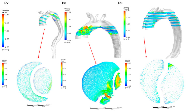 Figure 12