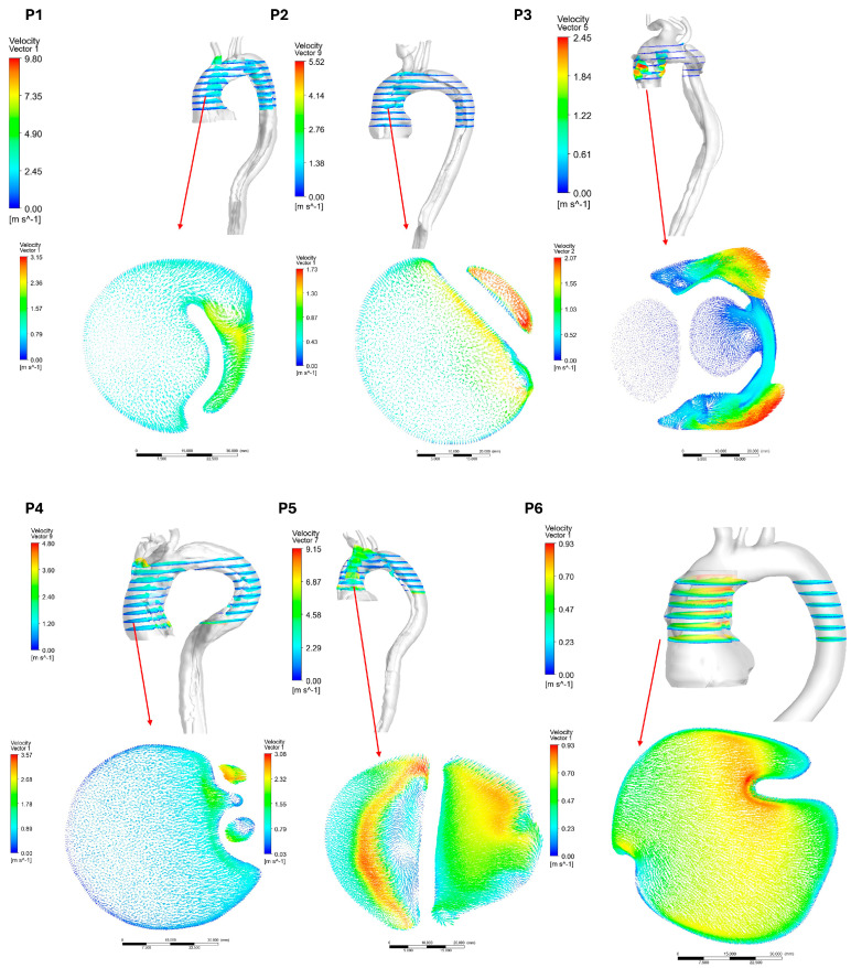 Figure 13