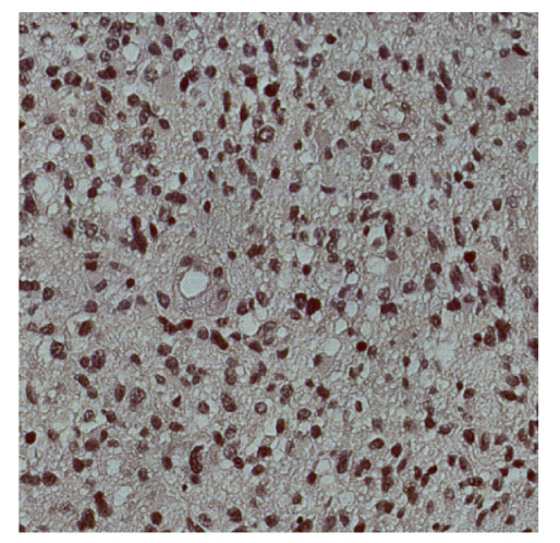 Figure 12