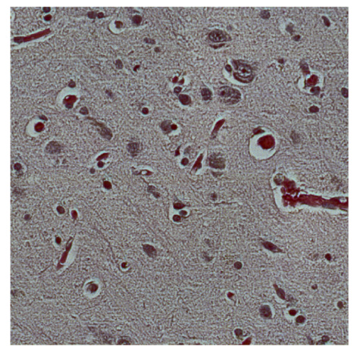 Figure 17
