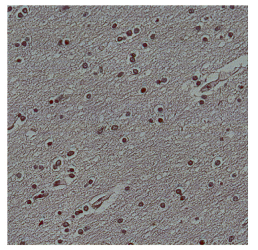 Figure 22