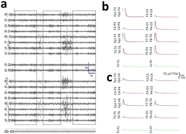 Figure 12