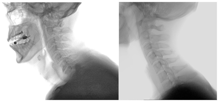 Figure 20