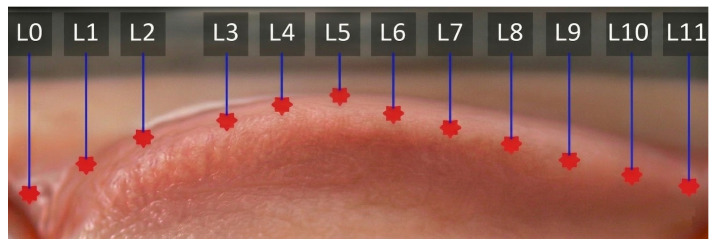 Figure 13