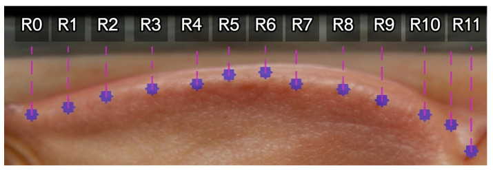 Figure 14